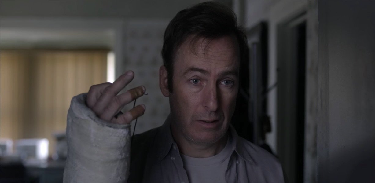 Close-up of Bob Odenkirk in an arm cast for the movie Girlfriend's Day.